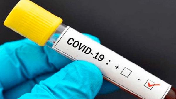 COVID-NEGATIVO