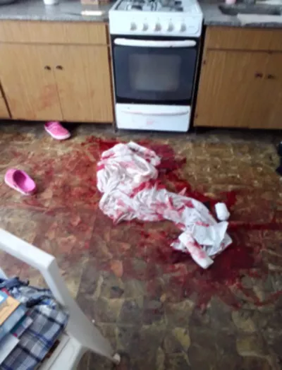 Ataque_Pitbull_Realicó