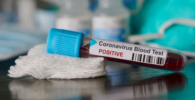 coronavirus